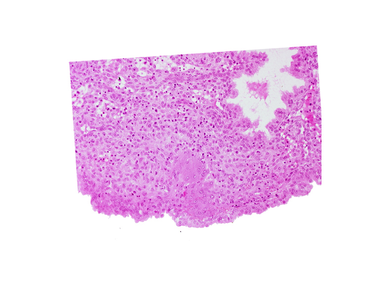 intact endometrial epithelium, lumen of endometrial gland, syncytiotrophoblast, uterine cavity