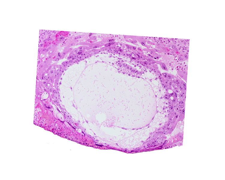 amniotic cavity, chorionic cavity, extra-embryonic mesoblast, primary umbilical vesicle cavity