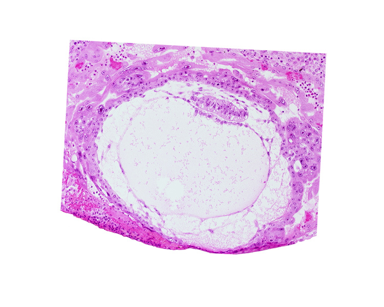 chorionic cavity, exocoelomic (Heuser's) membrane, primary umbilical vesicle cavity