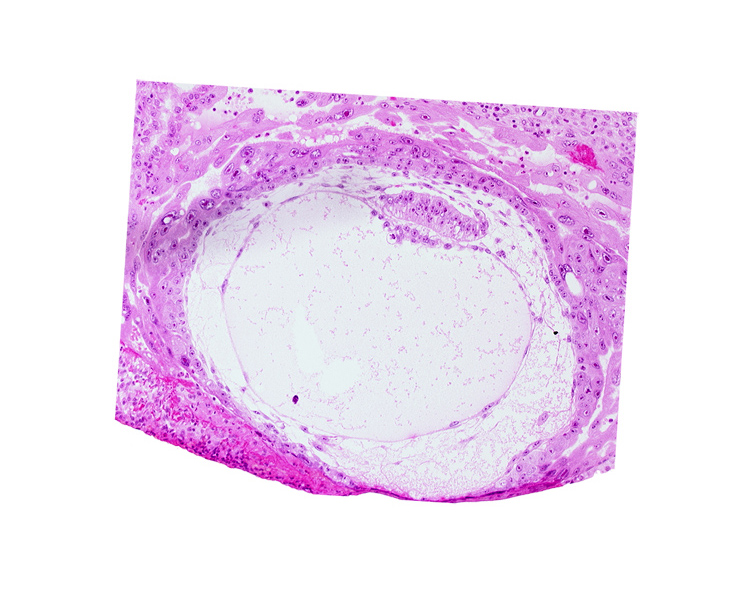 chorionic cavity, fibrous coagulum, presumptive prechordal plate, primary umbilical vesicle cavity