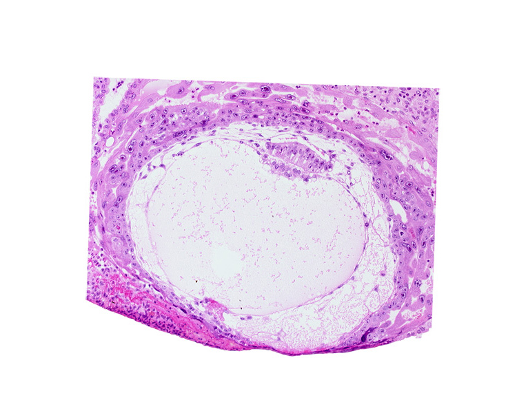 amniotic cavity, chorionic cavity, extra-embryonic reticulum, primary umbilical vesicle cavity, uterine cavity