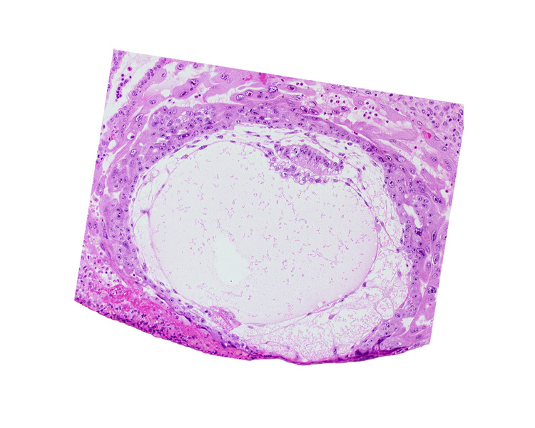 amniotic cavity, chorionic cavity, extra-embryonic reticulum, primary umbilical vesicle cavity, uterine cavity