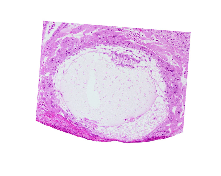 chorionic cavity, condensed extra-embryonic mesoblasts, embryonic disc, endometrial epithelium, epiblast vacuole, exocoelomic (Heuser's) membrane, extra-embryonic mesoblast, fibrous coagulum, hypoblast vacuole, primary umbilical vesicle cavity, uterine cavity