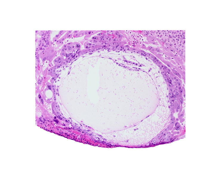 chorionic cavity, extra-embryonic mesoblast, lacunar vascular circle, primary umbilical vesicle cavity