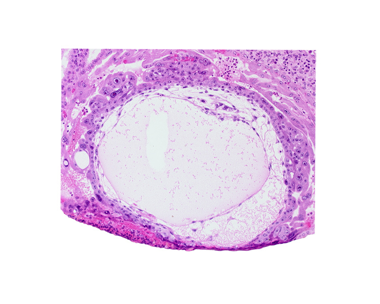 angioblastic tissue of mesoblast, chorion, chorionic cavity, cytotrophoblast, edge of amniotic cavity, epiblast, exocoelomic (Heuser's) membrane, extra-embryonic endoblast, extra-embryonic mesoblast, hypoblast, lacunar vascular circle, primary umbilical vesicle cavity, syncytiotrophoblast