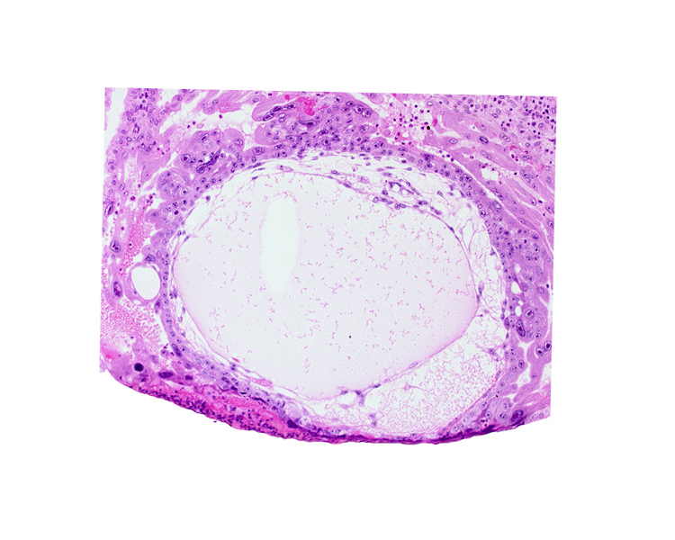 angioblastic tissue of mesoblast, chorionic cavity, edge of embryonic disc, primary umbilical vesicle cavity