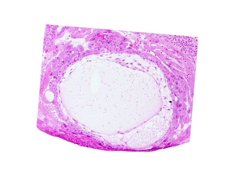 chorionic cavity, exocoelomic (Heuser's) membrane, primary umbilical vesicle cavity