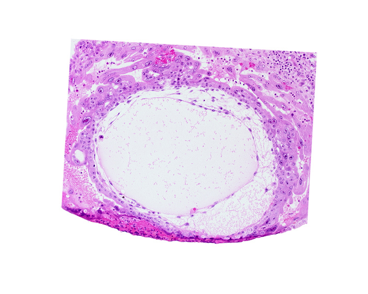 chorionic cavity, cytotrophoblast, primary umbilical vesicle cavity, syncytiotrophoblast, uterine cavity