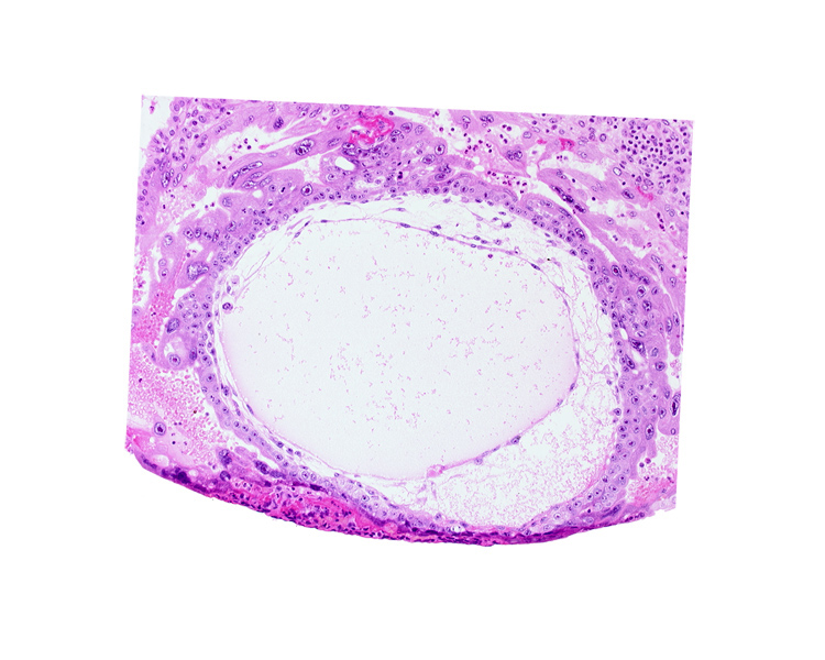 chorionic cavity, cytotrophoblast, primary umbilical vesicle cavity, syncytiotrophoblast, uterine cavity