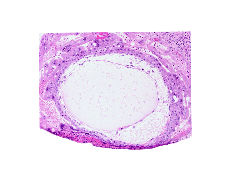 chorionic cavity, lacunar vascular circle, primary umbilical vesicle cavity, uterine cavity