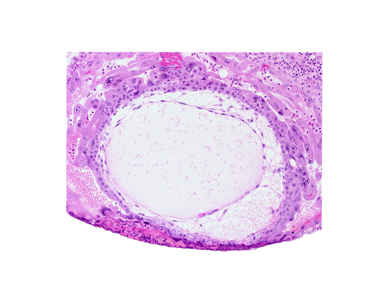 chorionic cavity, cytotrophoblast, lacunar vascular circle, primary umbilical vesicle cavity, syncytiotrophoblast