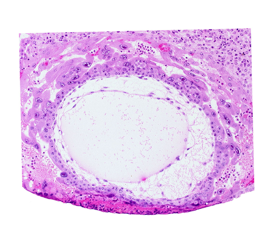 chorionic cavity, primary umbilical vesicle cavity, syncytiotrophoblast