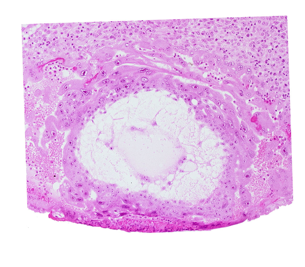 chorionic cavity, edge of primary umbilical vesicle cavity, extra-embryonic mesoblast, fibrous coagulum, syncytiotrophoblast, uterine cavity