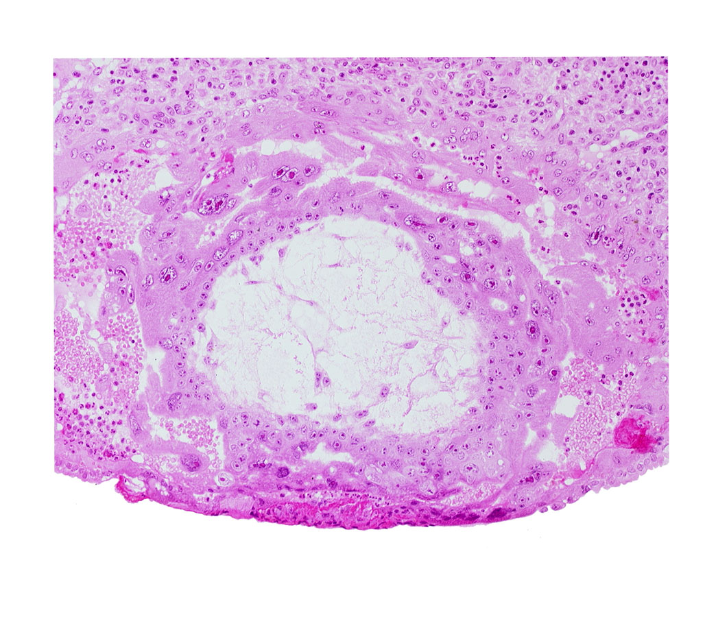 extra-embryonic mesoblast, extra-embryonic reticulum, fibrous coagulum, uterine cavity