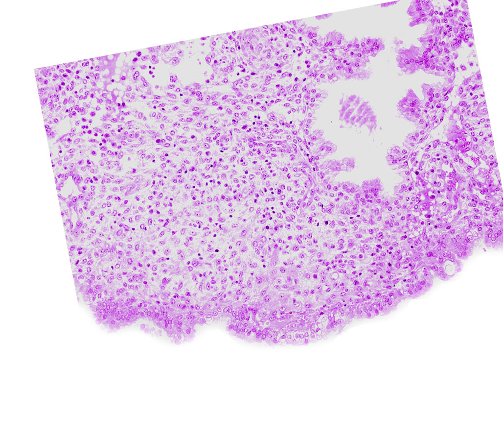 edge of syncytiotrophoblast, endometrial stroma (decidua), intact endometrial epithelium, lumen of endometrial gland, uterine cavity