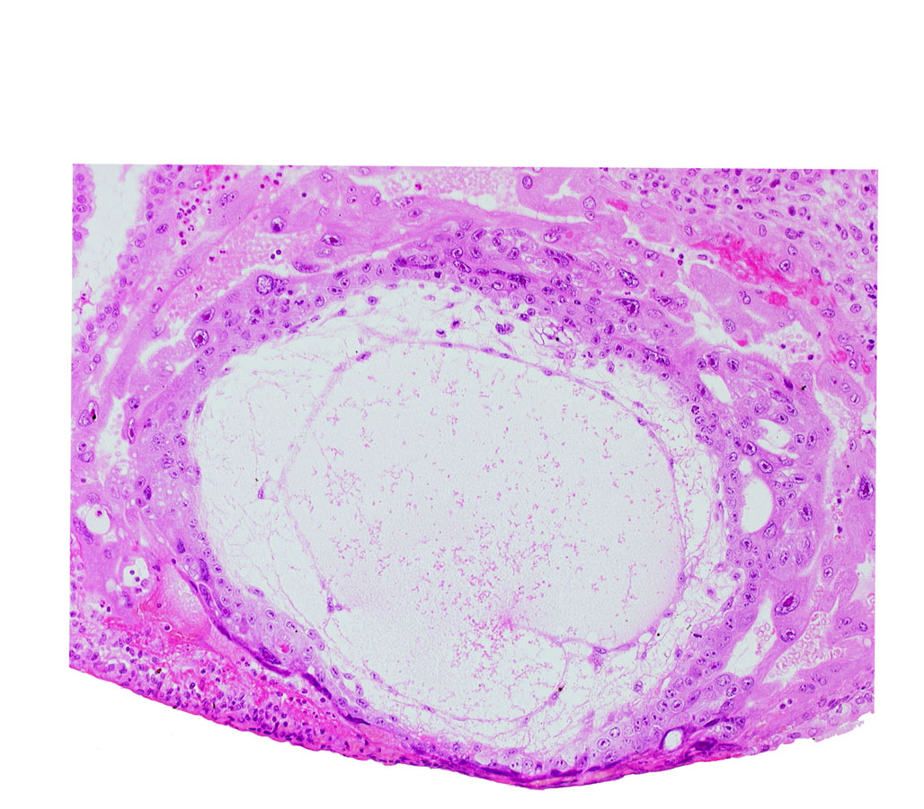 condensed extra-embryonic mesoblast, cytotrophoblast, exocoelomic (Heuser's) membrane, fibrous coagulum, lacunar vascular circle, previllus mesoblast clump, trophoblast lacunae