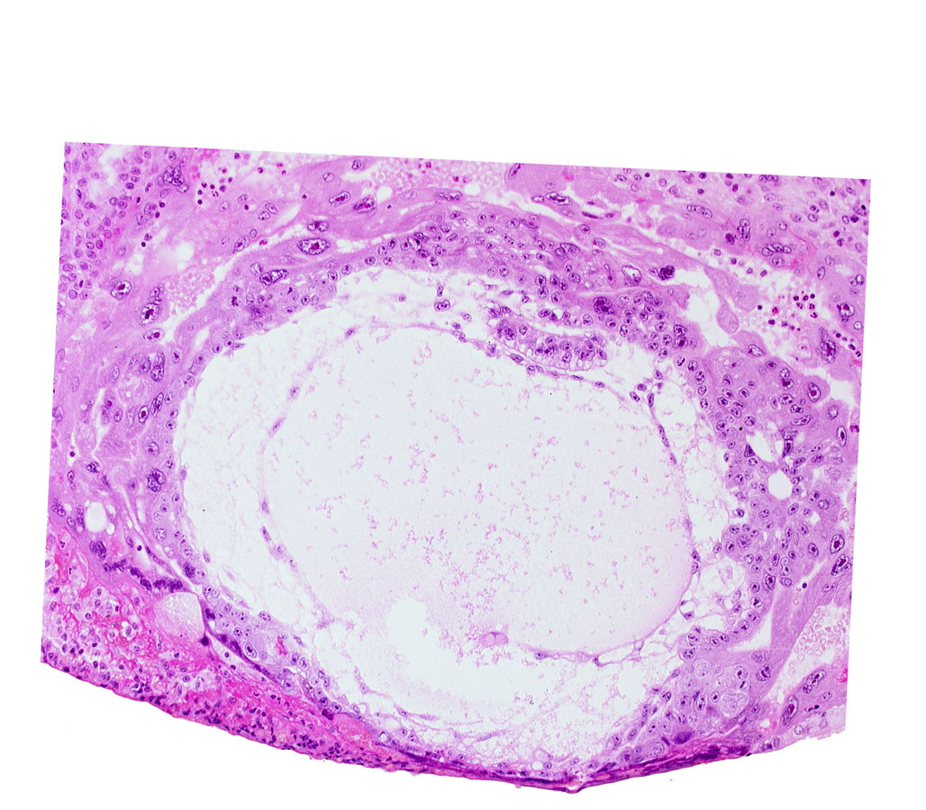 chorionic cavity, edge of amniotic cavity, extra-embryonic mesoblast