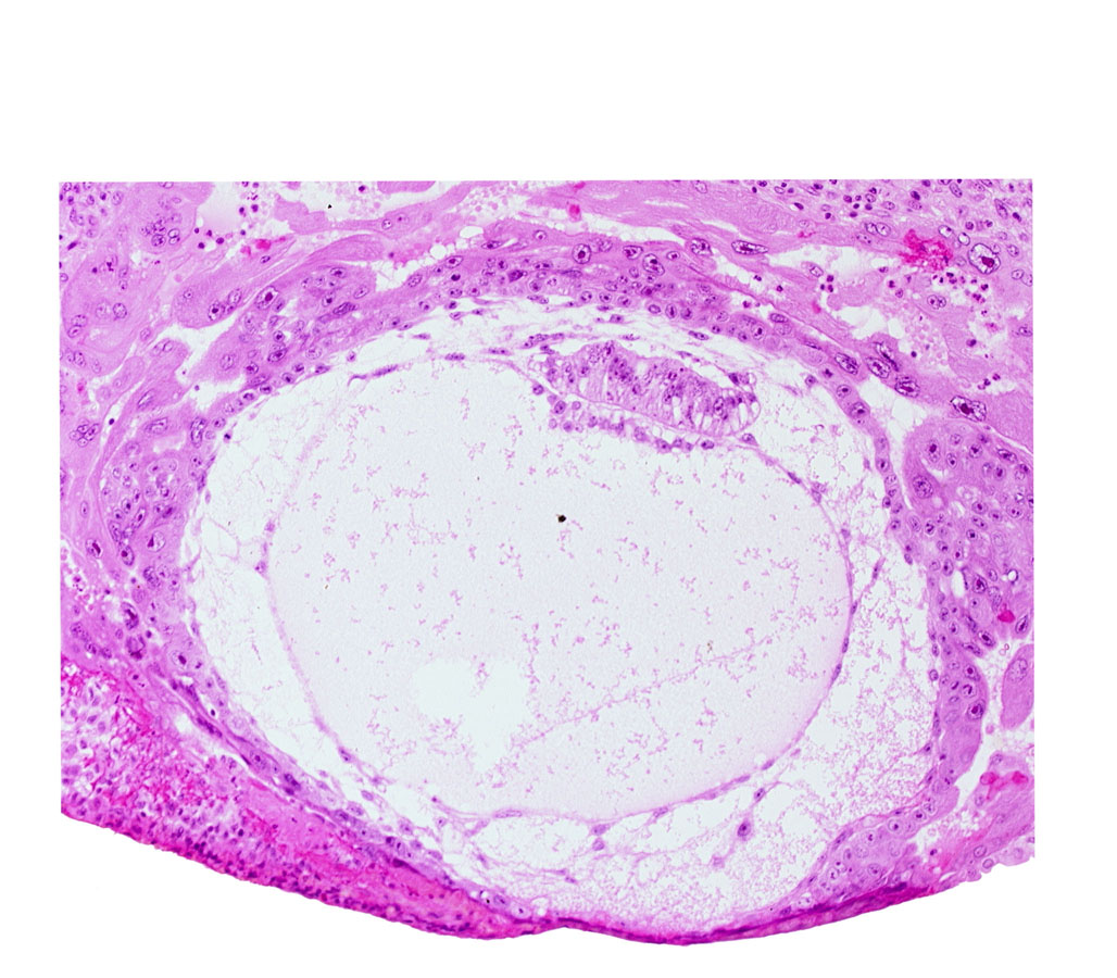 amnion, amniotic cavity, chorionic cavity, cytotrophoblast, epiblast vacuole, exocoelomic (Heuser's) membrane, extra-embryonic endoblast, fibrous coagulum, hypoblast, lacunar vascular circle, prechordal plate, previllus crest of mesoblast, primary umbilical vesicle cavity