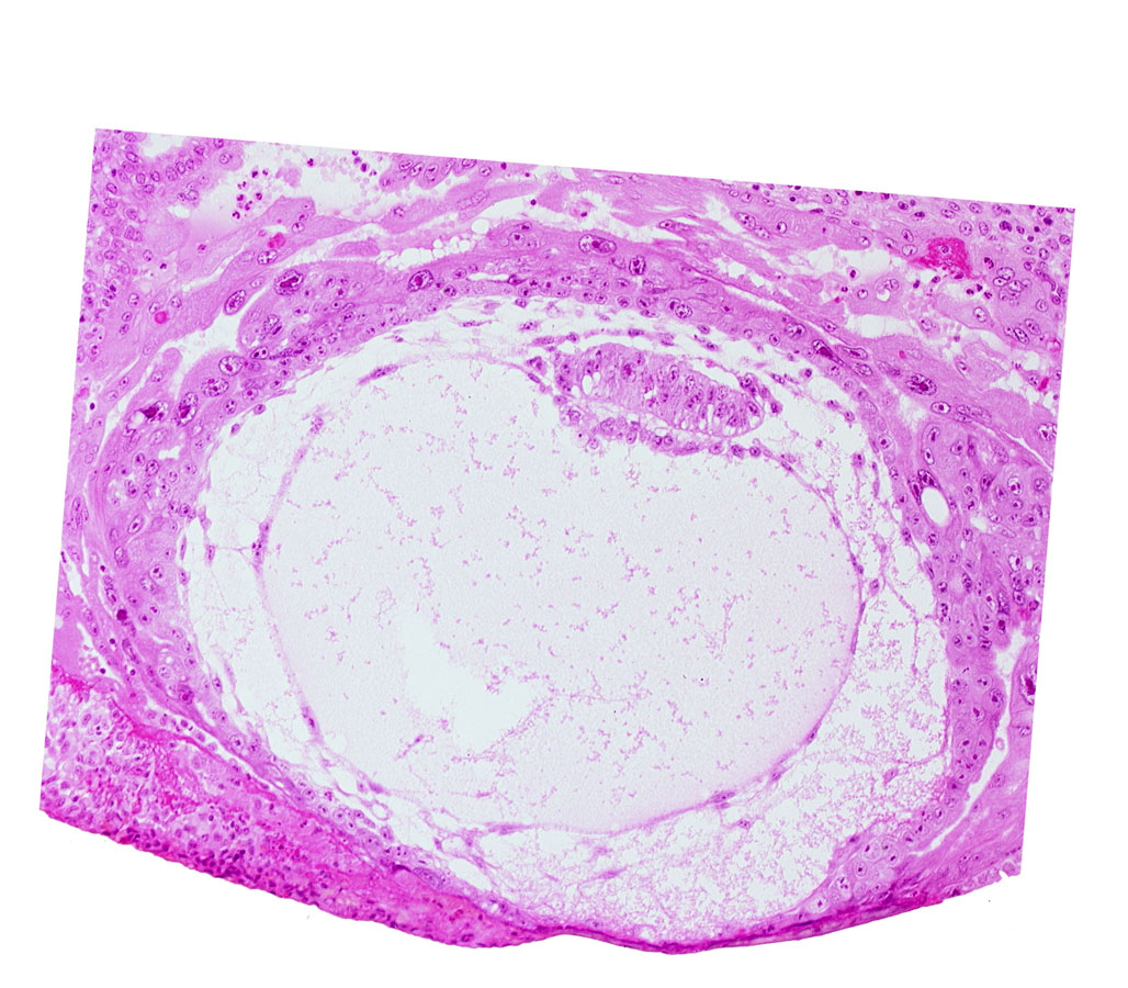 amniotic cavity, chorionic cavity, epiblast vacuole, fibrous coagulum, lacunar vascular circle, presumptive prechordal plate, primary umbilical vesicle cavity