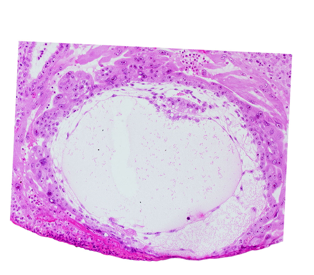 exocoelomic (Heuser's) membrane, extra-embryonic mesoblast, fibrous coagulum, primary umbilical vesicle cavity, uterine cavity