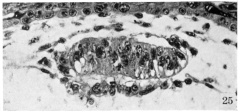 High-power view of embryo