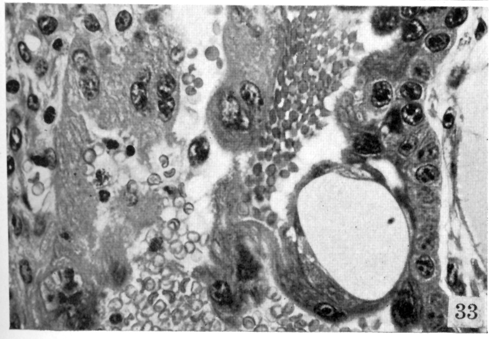 Forming syncytiotrophoblastic vacuole