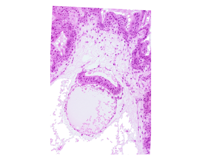 chorionic mesothelium, chorionic villi, epiblast, hypoblast, intervillus space(s), primordial connecting stalk