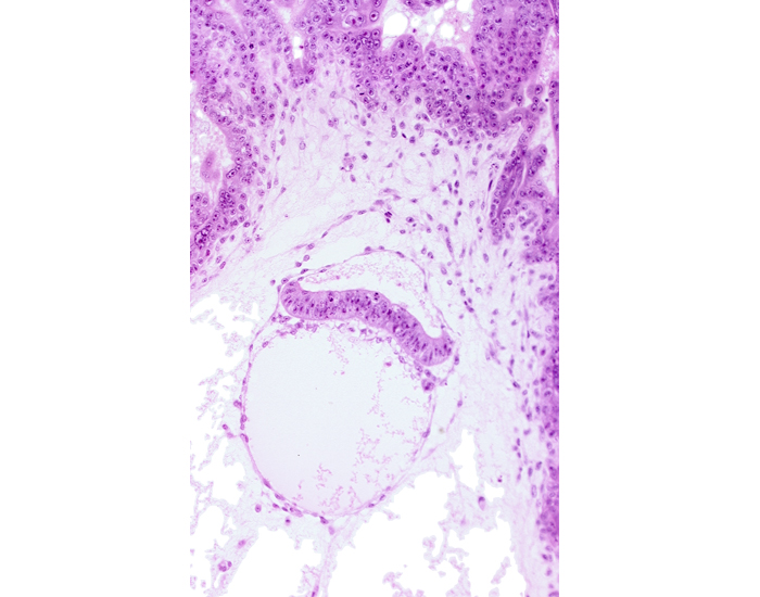 amnion, extra-embryonic coelom, intervillus space(s), secondary umbilical vesicle cavity