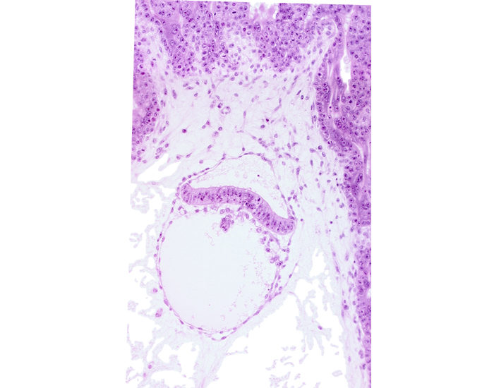 amnion, amniotic cavity, head mesenchyme, secondary umbilical vesicle cavity