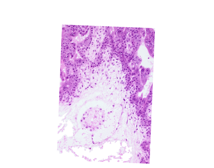 cephalic part of secondary umbilical vesicle wall, extra-embryonic coelom (exocoelom), mesoblast (mesenchyme)