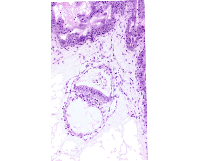 amniotic cavity, epiblast, hypoblast, intervillus space(s), secondary umbilical vesicle cavity, stem villus, two-layered amnion