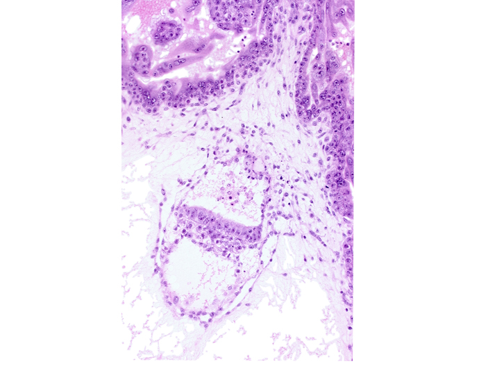 amniotic cavity, embryonic endoderm, embryonic mesoderm, primary villus, primordial gastrulation (primitive) streak, secondary umbilical vesicle cavity