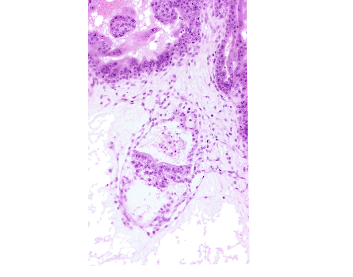 caudal part of secondary umbilical vesicle cavity, cephalic part of primordial gastrulation (primitive) groove, embryonic endoderm, epiblast, extra-embryonic endoderm, intervillus space(s), presumptive amniotic duct, primary villus, site of epitheliomesenchymal transformation, stem villus