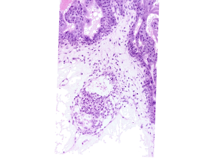 caudal edge of secondary umbilical vesicle cavity, extra-embryonic coelom, presumptive allantoic diverticulum, secondary umbilical vesicle process