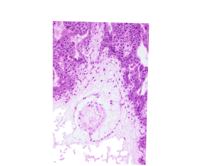 extra-embryonic coelom (exocoelom), intervillus space(s)