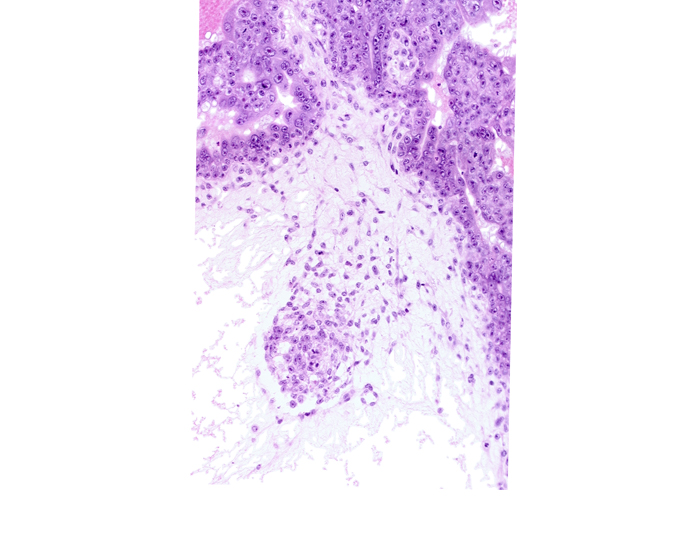 extra-embryonic mesoblast, intervillus space(s), primordial blood vessel(s), syncytiotrophoblast