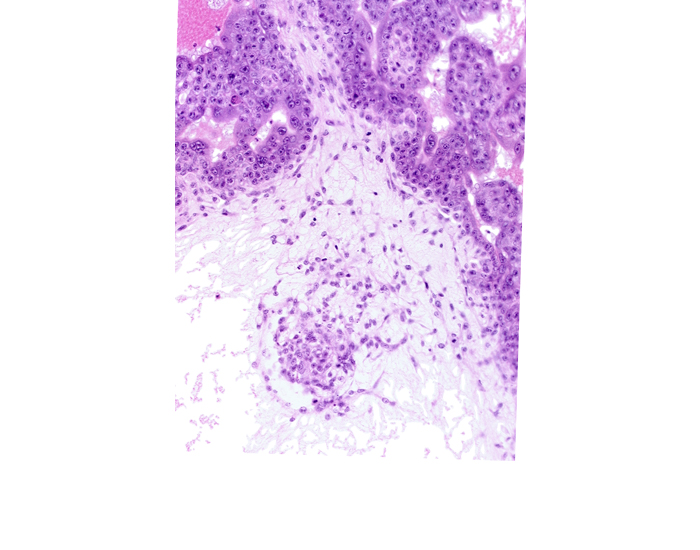 extra-embryonic coelom, extra-embryonic mesoblast, intervillus space(s)