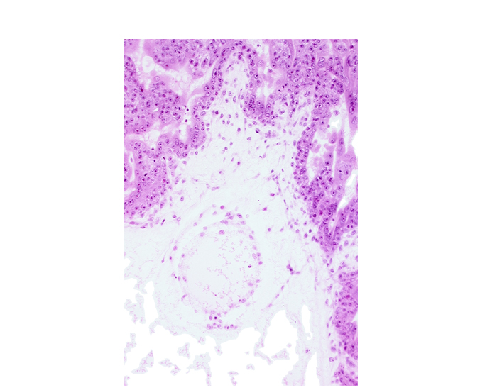 extra-embryonic coelom (exocoelom), trophoblast