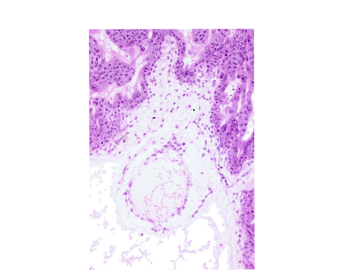 cephalic edge of embryonic disc, extra-embryonic coelom, extra-embryonic somatopleuric mesoderm, mesoblast (mesenchyme), secondary umbilical vesicle cavity, secondary umbilical vesicle wall, stem villus