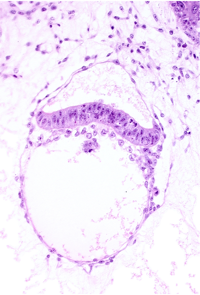 amniotic cavity, intervillus space(s), junction of extra-embryonic endoderm and hypoblast, secondary umbilical vesicle cavity