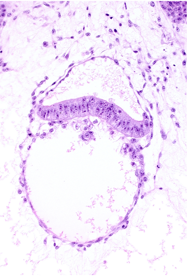 epiblast, extra-embryonic coelom, extra-embryonic ectoderm, head mesenchyme, hemangioblast, hypoblast, primordial connecting stalk, primordial germ cell(s)