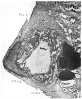 Implantation site