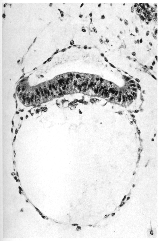 Embryo and secondary umbilical vesicle