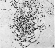 Amniotic cavity