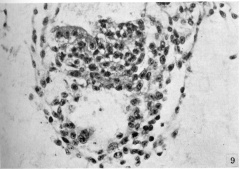 Undifferentiated cell mass