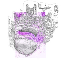 Median sagittal plane - Overlay