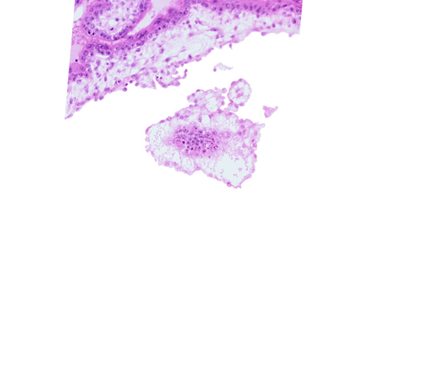 cephalic edge of embryonic disc, chorionic cavity