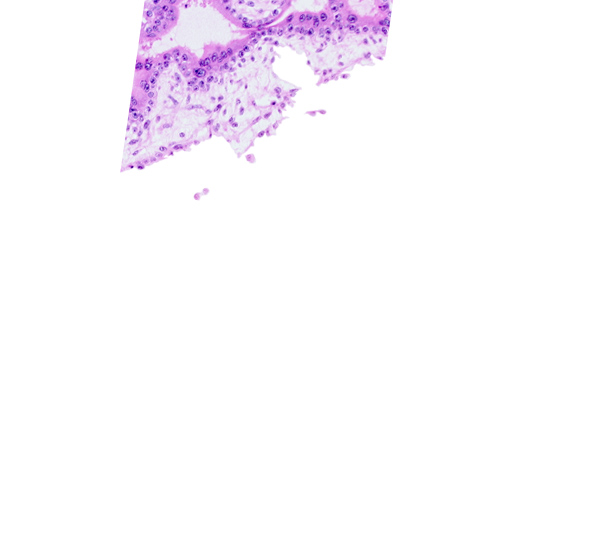 chorion, chorionic cavity (extra-embryonic coelom or exocoelom), cytotrophoblast, floating villus, intervillus space(s), syncytiotrophoblast