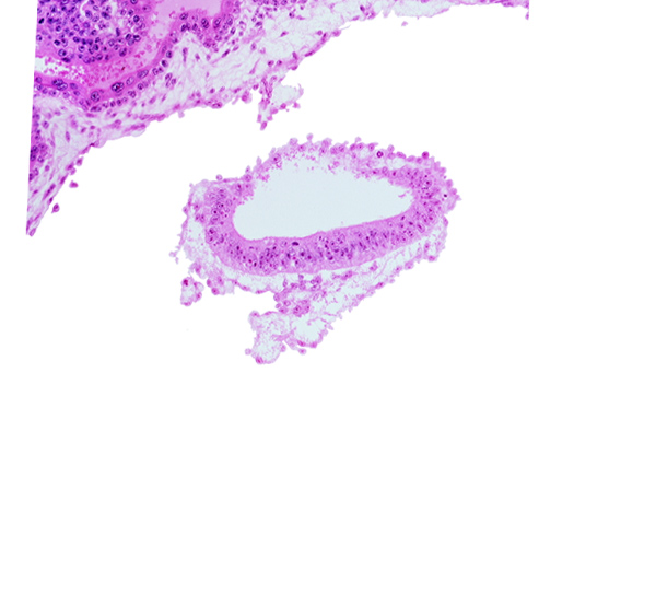 amnion, cephalic part of connecting stalk, head mesenchyme