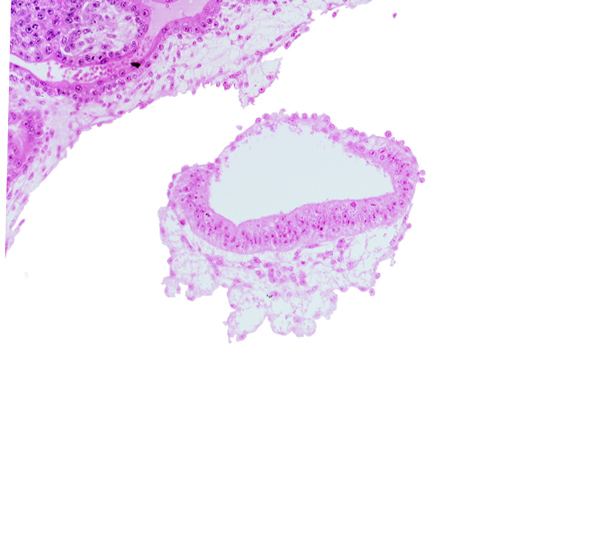 amnion, amniotic cavity, extra-embryonic mesoblast (somatopleuric layer), head mesenchyme